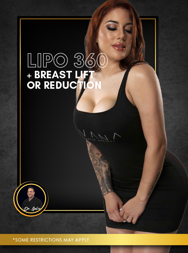 Lipo 360 plus Breast lift or Reduction with Dr Golio